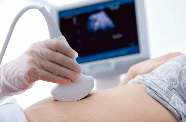 3D And 4D Ultrasound Machines