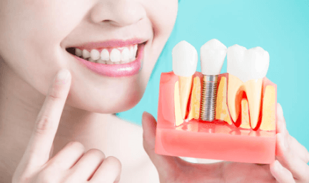 Dental Implants Make New Teeth in a Day Feasible