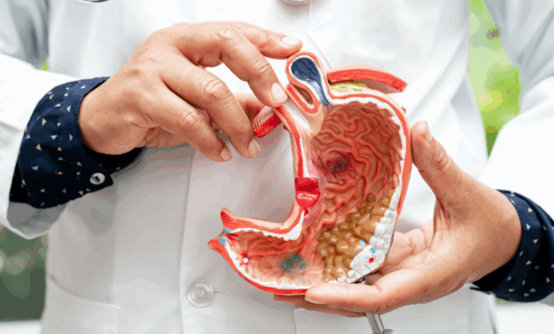 Can the Stomach Grow Again After Gastric Sleeve?