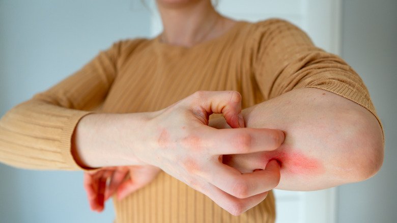 Natural Remedies for Skin Irritations You Can Try at Home