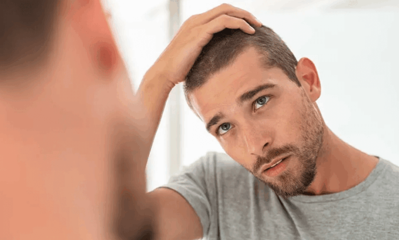 Understanding Hair Loss Treatment for Men: Causes, Options and Advanced Solutions